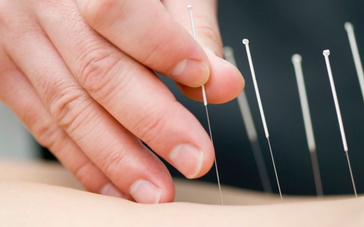 Acupuntura y Moxibustión